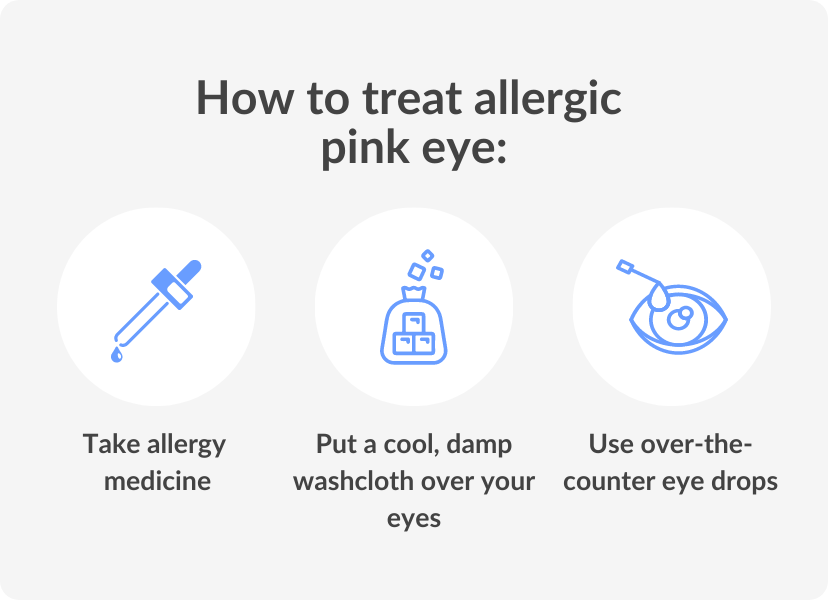 How to treat Allergic conjunctivitis